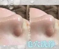 気になる毛穴をキレイに！！✨毛穴洗浄Tゾーン¥4400→¥3300
