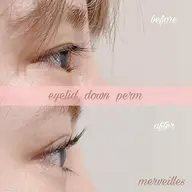 下まつげパーマ⭐️アイリッドダウンパーマ⭐️逆さまつ毛/たるみ/クマ/中顔面短縮アイシャンプー&ヒト幹細胞美容液付き⭐️