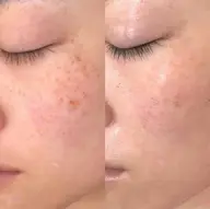 選べる高濃度美容液✨イオン導入‼️✨