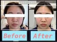 👑オーダーメイド小顔👑【60分/13200円→4980円】