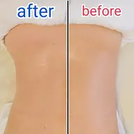 ミニモ限定コース✴️フェイシャル+ボディマッサージ✴️お顔と背中と腕をケア！