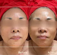 【本気で美しくなりたい方はコチラ✨】細胞活性トリートメント