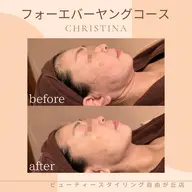 【クリスティーナ】フォーエバーヤング❣️小顔・リフトアップ🪞