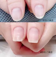 《美爪育成ネイルケア3ヶ月コース》合計8回(ご来店目安2週に1回)定期的なケアで自爪を健やかに保ち爪床の育成を促します
