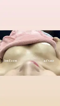 【バストケア】バストアップ施術(光施術付き)