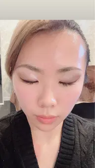 ダイヤモンドピールプログラム 施術時のお写真を掲載モデル