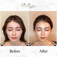 【3月 限定‼️】小顔矯正＋ヘッドスパ（頭蓋骨矯正）¥14,000→3,000