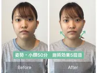 【アンケート特別価格】顔の歪み左右差＆小顔矯正+姿勢矯正【50分17900→0】※先着3名