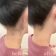 【脇・うなじ・指】いずれか1箇所のお手軽脱毛