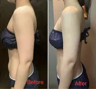 【二の腕集中ケア】60分　今年こそはノースリーブを着たい！そこのあなた！理想の二の腕のへの入り口✨