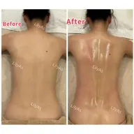 期間限定★痩身モニター募集★肉の燃焼！部分痩身80分