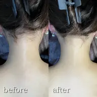 【イベント前に】えり足・うなじ脱毛