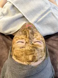 ハーブピーリング🌿シミ、シワたるみ、毛穴に‼️剥離なし✨