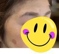 アイブロウ　ワックス脱毛