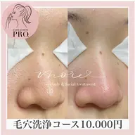 《毛穴超洗浄》ヒト幹細胞培養液×毛穴エクストラクション🌱黒ずみ/ザラつき/テカリ/開き/たるみ毛穴など、お悩み解消