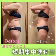 新機械導入❤️🔥人気NO.1💆♀️4STEPでお腹徹底痩身!!! ビュースタオリジナルの最強メソッド⸝⋆