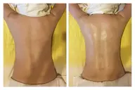 【破格‼️】お試し背中ケア（セル脂肪ケア➕リンパドレナージュ）