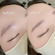 眉ワックス脱毛