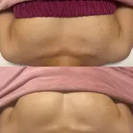 冷え×巡り改善！バスト✕鉄✕ビタミンBR