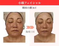 周年記念【小顔】造形マッサージ+背中マッサージ+ツヤ肌パック60分