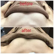 【バストケア】¥3,500バスト深部に専用機を照射すると、血流リンパの流れが良くなり、ハリと弾力のあるバストへ導きます。