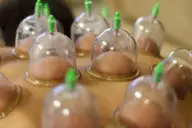 【爽快★全身の重だるさに】全身アロマ+吸い玉(カッピング)ORハイパーナイフ1箇所+ヒートマット 120分