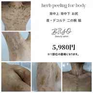 超得‼︎【ボディ碧ハーブピーリング】背中ニキビ◎二の腕のぶつぶつ◎改善したい部位に◇マッサージ付き◎♪60分￥5,980