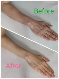 【初回限定】ハンドトリートメント 30分　✨ハンドケア