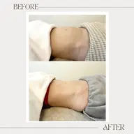 クビレ革命✨【よもぎ蒸し+腸もみ&ヘッド付】感動レベルの体感🌿発汗×高技術でクビレをつくる+極上リラックス☁️