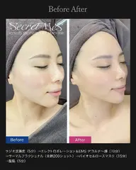 マスク老け対策！シークレットメスリッチフェイシャル