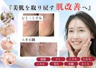 【肌質改善】シミ・くすみ★ハーブピーリング&プラズマ