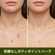 【ポイント施術】ボディハーブピーリング(剥離なし)ヒト幹細胞培養上清液入りハーブ🌿お尻/背中上or下/デコルテ/足/腕