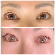 バインドロック80束