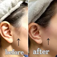 パーツwax(1パーツ)おでこ、もみあげ、鼻、鼻下、頬、あご(フェイスライン含む)