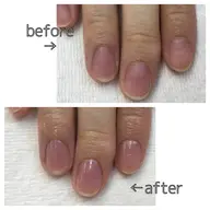 【美爪ケア】甘皮ウォーターケア＋整爪（お湯で甘皮を柔らかく→甘皮ケア→爪を整える→オイル塗布♡