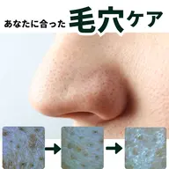 黒ずみ毛穴　角栓詰まりにお悩みの方　自宅ケアセット付き　毛穴をキュッとしめるスペシャルケア