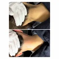 うなじワックス脱毛