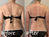 肩こり、たるみ、浮腫などお悩みに合わせて筋膜リリース&リンパボディ80分13200円→11000円