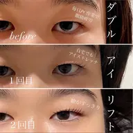アイマッサージ付まつ毛パーマ【ダブルアイリフト】奥二重や眼精疲労でお悩みの方におすすめ！！