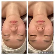 【3/31まで期間限定お試し価格】💕時短/即効性＆小顔コルギ💕40分 デコルテ、首リンパ、ヘッドスパ、美容マスク付き