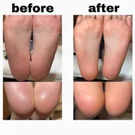 フット💜角質ケア✨角質ケアのみご予約の場合はこちら💕【フットバス付】