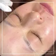 【モデル価格】シルク糸脱毛×酵素フェイシャルエステ