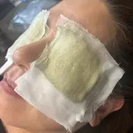 グリーンピールアイサークルトリートメント