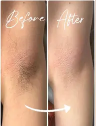 🩷SHR脱毛🩷全身(顔、VIO除)サクッと終わる人気メニュー✨🌱