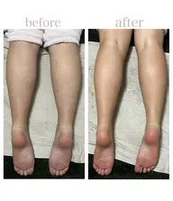 リンパ🌿リラクゼーション【60分】