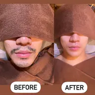 ✨ メンズ ✨ヒゲ 髭 ひげ ブラジリアンワックス脱毛¥6500✨