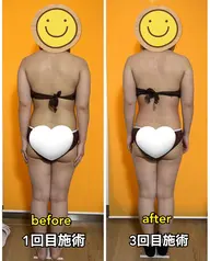 クリスマスまでに痩せなきゃ!背中ムチムチ!ぽっこりお腹を3回でなんとかします!骨盤矯正➕全身痩身マッサージ!