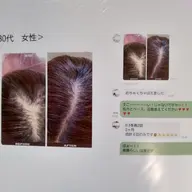 【薄毛・細毛・健康頭皮へ】頭皮ケア　スカルプ棘ケア3回コース