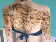 【ブライダルの予定がある方必見★】半年前からのハーブピーリング背中全体