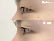 メンズ【まつ毛パーマ】まつ毛が下がってる方必見✨